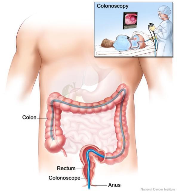 Gastroenteritis Treatment
