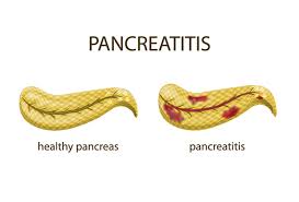 Gastroenteritis Treatment