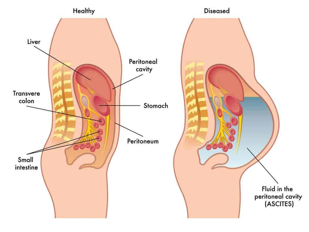 livertreatments
