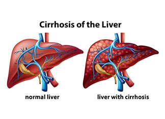 livertreatments