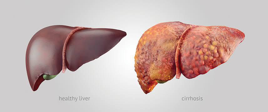 livertreatments